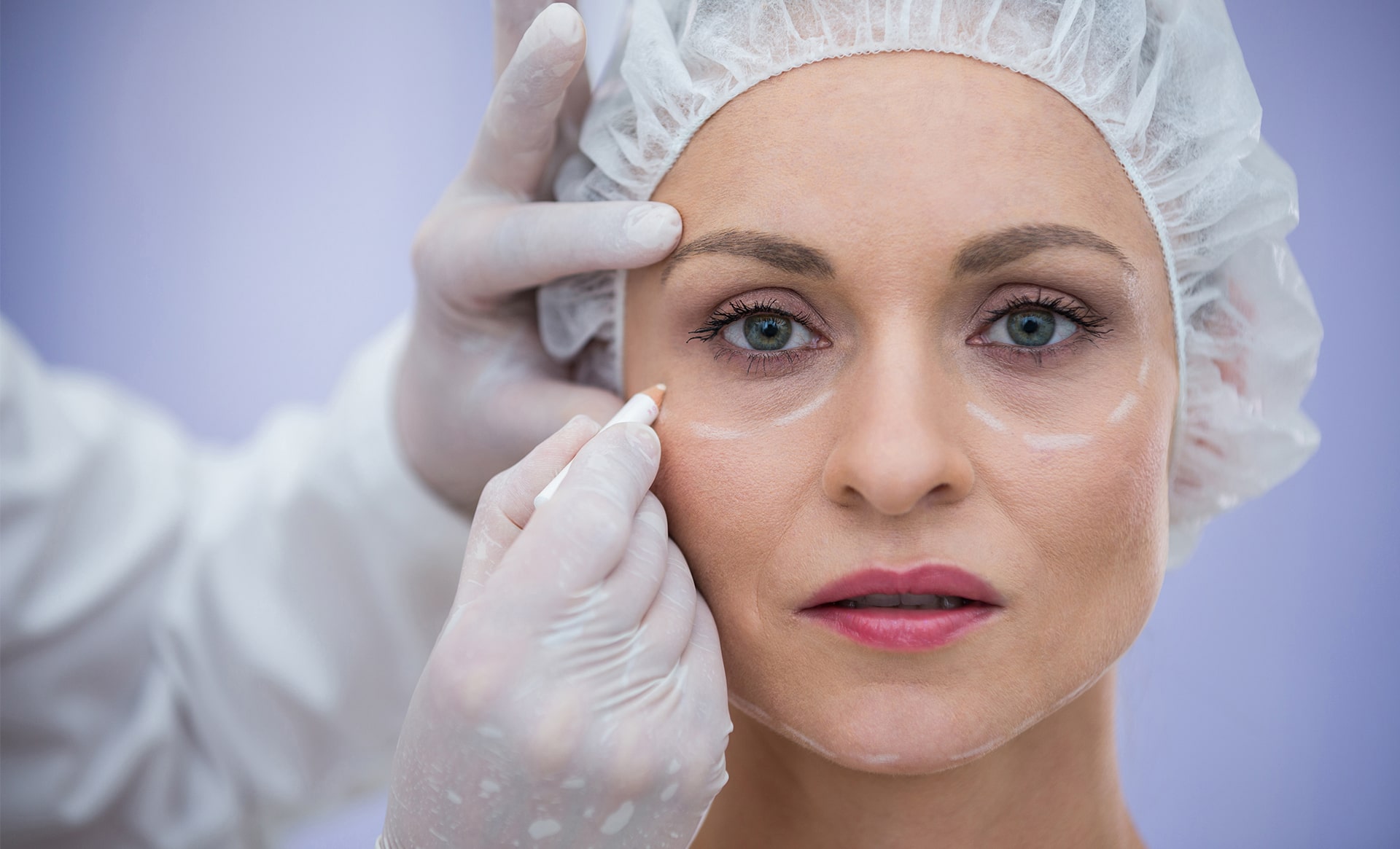 dark circles remedies 01