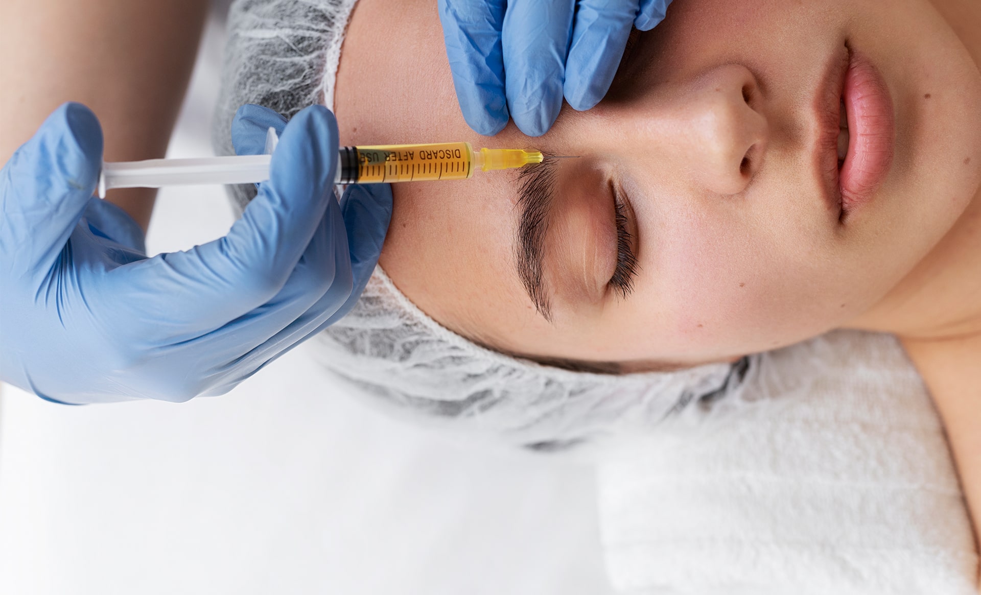 mesotherapy skin rejuvenation 01