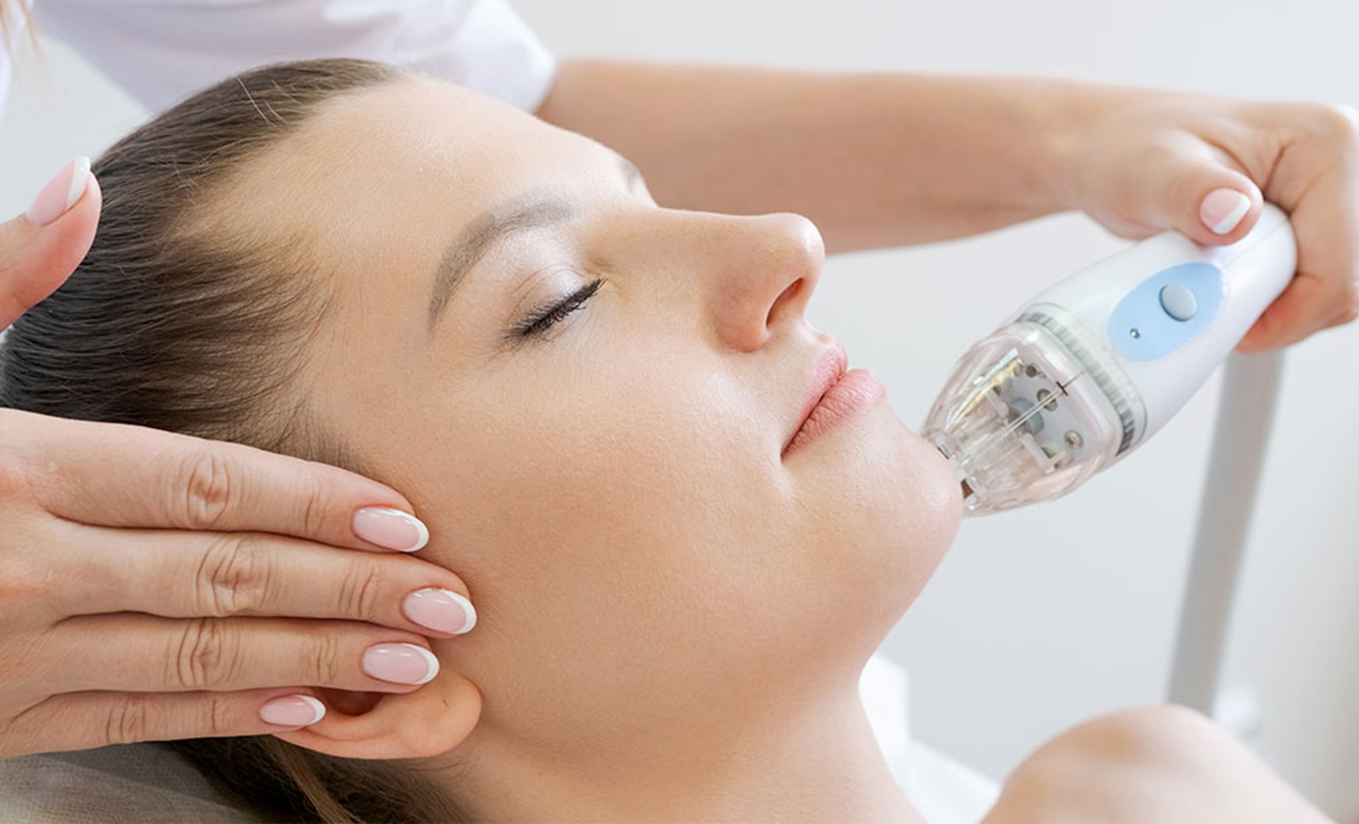 microneedling benefits 01